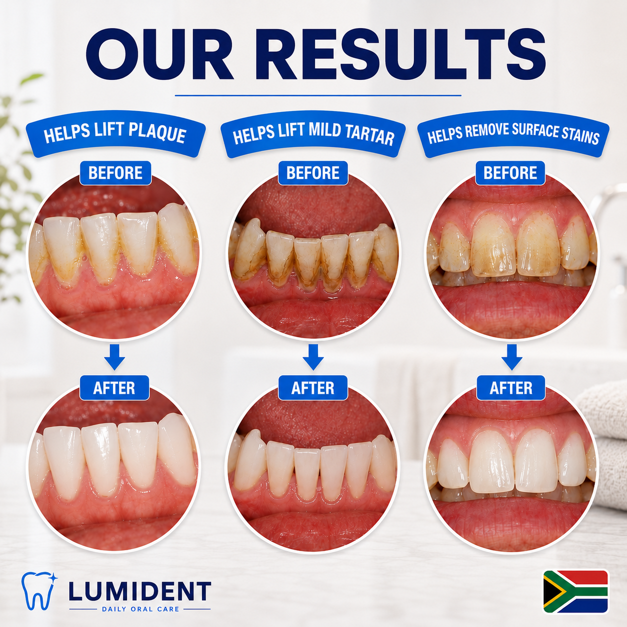Lumident Ultrasonic Tooth Cleaner — A Dentist-Clean Smile, From Home